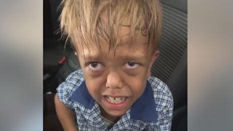 Australie : stars et anonymes se mobilisent pour Quaden, un garçon de 9 ans victime de harcèlement en raison de son handicap